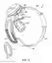 Fig. 17 - Uses for eye tracking in a visual prosthesis