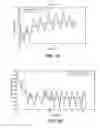 Fig. 03 - Methods and systems for lowering blood pressure through reduction of ventricle filling