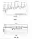 Fig. 04 - Methods and systems for lowering blood pressure through reduction of ventricle filling