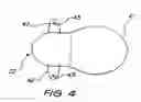 Fig. 05 - Fixation system for an implantable medical device