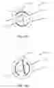 Fig. 28 - Systems and methods for use in emission guided radiation therapy
