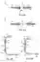 Fig. 14 - Particle therapy systems, devices, and methods for beam transportation