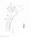 Fig. 22 - Adjustable resistance and braking system for exercise equipment
