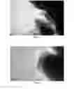 Fig. 02 - Zeolite adsorbents with low binder content and large external surface area, method for preparation of same and uses thereof