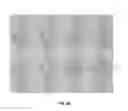 Fig. 18 - SINGLE CELL PATTERNING AND COORDINATED TRANSFER OF PATTERNED CELLS