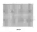 Fig. 19 - SINGLE CELL PATTERNING AND COORDINATED TRANSFER OF PATTERNED CELLS