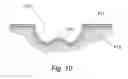 Fig. 09 - LOCALIZED TEMPERATURE CONTROL FOR SPATIAL ARRAYS OF REACTION MEDIA