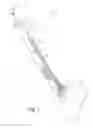 Fig. 02 - Tension fed fastener installation tool and related methods of use