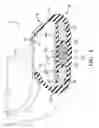 Fig. 02 - Tripletube tire