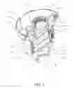 Fig. 06 - Helicopter hoist systems, devices, and methodologies