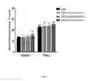 Fig. 06 - Methods for treating type 1 diabetes using glucagon receptor antagonistic antibodies