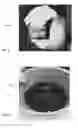 Fig. 02 - Acellular biologic composition and method of manufacture
