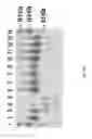 Fig. 49 - HIGHER PERFORMANCE PROTEASES FOR SCARLESS TAG REMOVAL