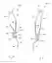 Fig. 43 - Turbine assembly for hydrokinetic torque converter, and method for making the same