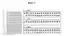 Fig. 04 - Phosphorothioate DNAzyme complexes and use thereof