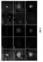 Fig. 05 - CIRCULATING TUMOR CELL DIAGNOSTICS FOR THERAPY TARGETING PD-L1