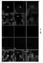 Fig. 11 - CIRCULATING TUMOR CELL DIAGNOSTICS FOR THERAPY TARGETING PD-L1
