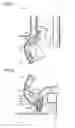 Fig. 06 - Image forming apparatus with coupling member having two rotation pivots