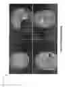 Fig. 07 - System and method for managing equipment in a medical procedure