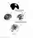 Fig. 07 - System and method for providing assistance in surgery in presence of tissue deformation