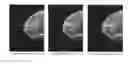 Fig. 01 - Tomographic image generation device, radiography imaging system, tomographic image generation method and tomographic image generation program storage medium