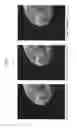 Fig. 07 - Tomographic image generation device, radiography imaging system, tomographic image generation method and tomographic image generation program storage medium