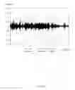 Fig. 07 - Electronic device and method for classifying voice and noise