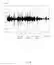 Fig. 08 - Electronic device and method for classifying voice and noise