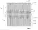 Fig. 03 - Solar cell with specific front surface electrode design