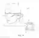 Fig. 10 - Low profile interconnect for light emitter