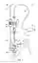 Fig. 02 - Surgical system having a guide catheter including a fluid passageway