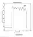 Fig. 08 - Composite ocular blood flow analyzer