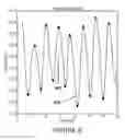 Fig. 12 - Composite ocular blood flow analyzer