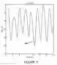 Fig. 13 - Composite ocular blood flow analyzer