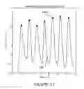 Fig. 15 - Composite ocular blood flow analyzer