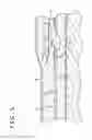 Fig. 06 - Dissecting device