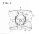 Fig. 07 - Dissecting device
