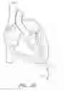 Fig. 03 - Suturing devices and methods for suturing an anatomic valve