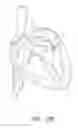 Fig. 04 - Suturing devices and methods for suturing an anatomic valve