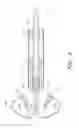 Fig. 11 - Suturing devices and methods for suturing an anatomic valve