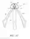 Fig. 15 - Suturing devices and methods for suturing an anatomic valve