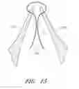 Fig. 18 - Suturing devices and methods for suturing an anatomic valve