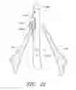 Fig. 24 - Suturing devices and methods for suturing an anatomic valve