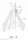 Fig. 28 - Suturing devices and methods for suturing an anatomic valve