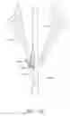 Fig. 35 - Suturing devices and methods for suturing an anatomic valve