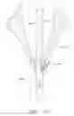Fig. 40 - Suturing devices and methods for suturing an anatomic valve