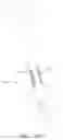 Fig. 43 - Suturing devices and methods for suturing an anatomic valve
