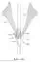 Fig. 47 - Suturing devices and methods for suturing an anatomic valve