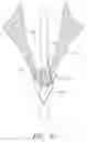 Fig. 51 - Suturing devices and methods for suturing an anatomic valve