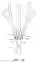 Fig. 53 - Suturing devices and methods for suturing an anatomic valve